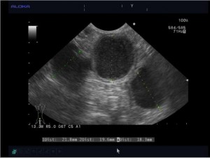 pyometra001